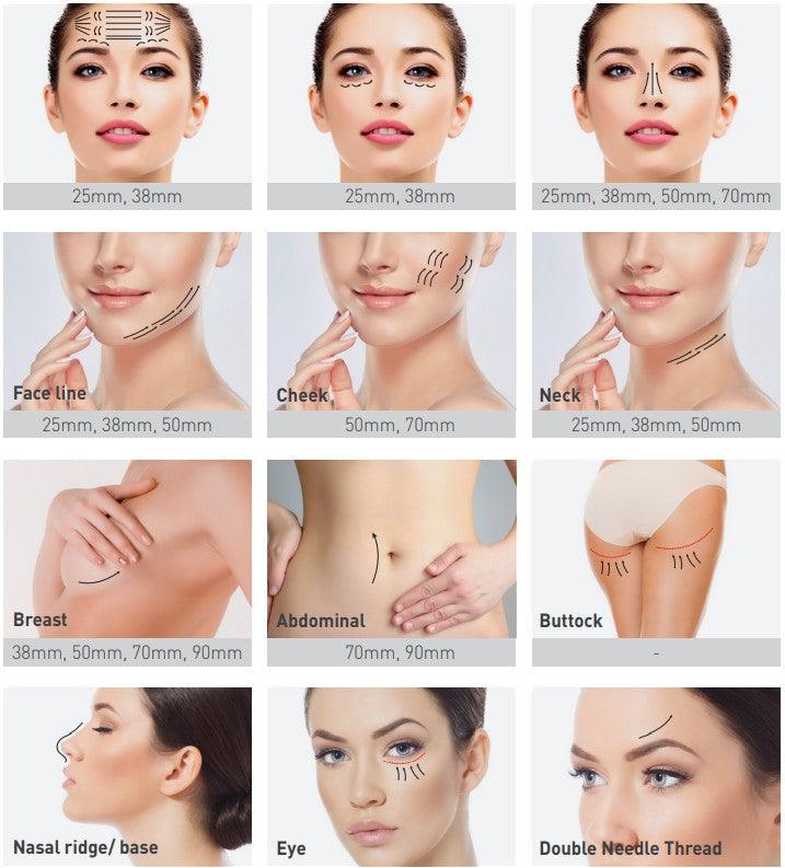 Neo Muiti Thread Lifting - Twin PDO - SL Medical