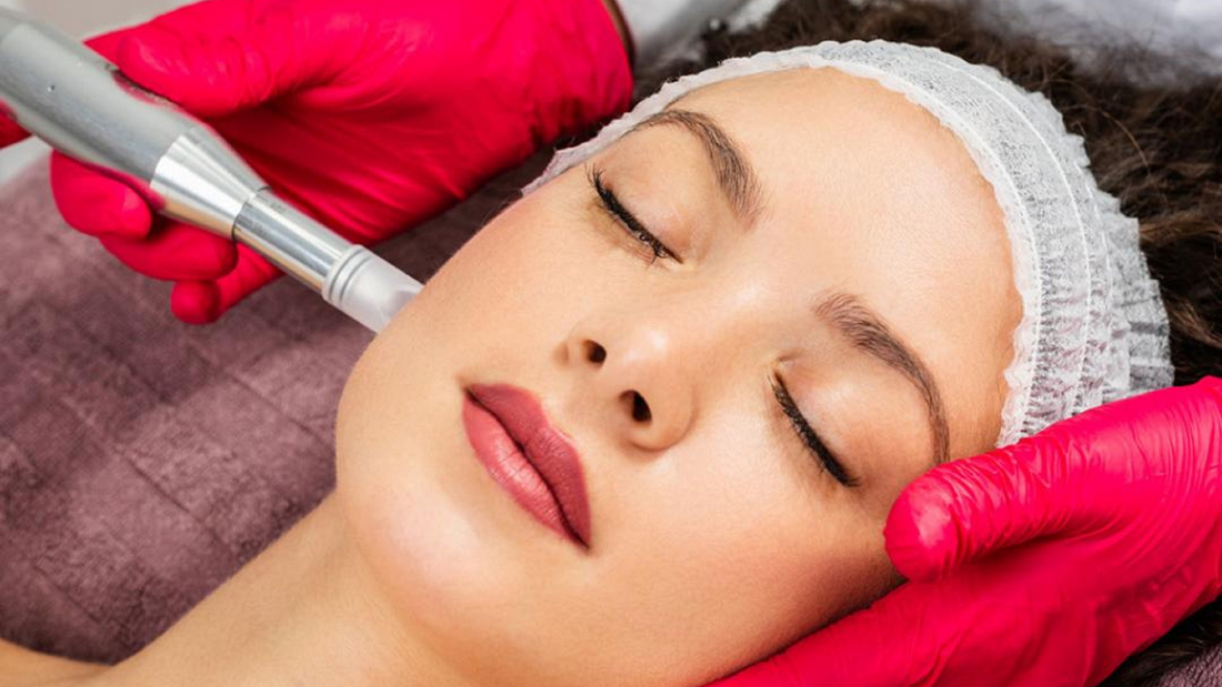 microneedling