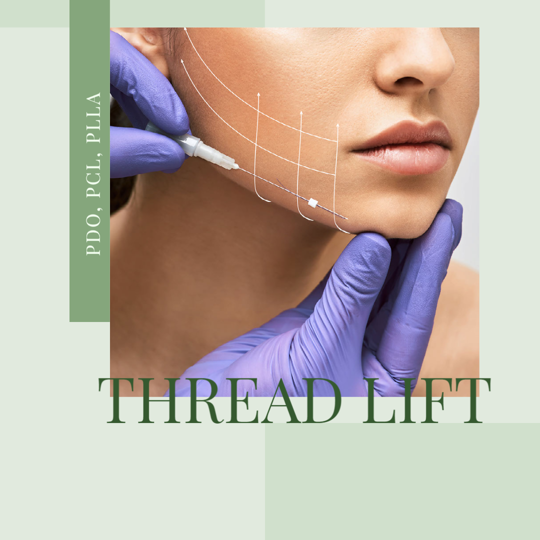 Get to Know the Different Types of Lifting Threads – SL Medical